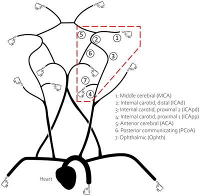 A multiscale computational framework to evaluate flow alterations during mechanical thrombectomy for treatment of ischaemic stroke